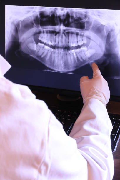 Best Emergency Tooth Extraction in Villanova, PA
