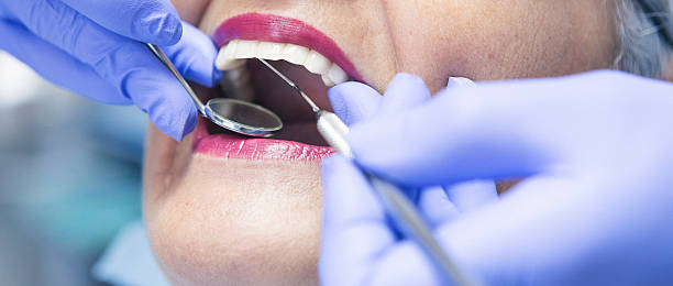 Best Emergency Wisdom Teeth Removal in Villanova, PA